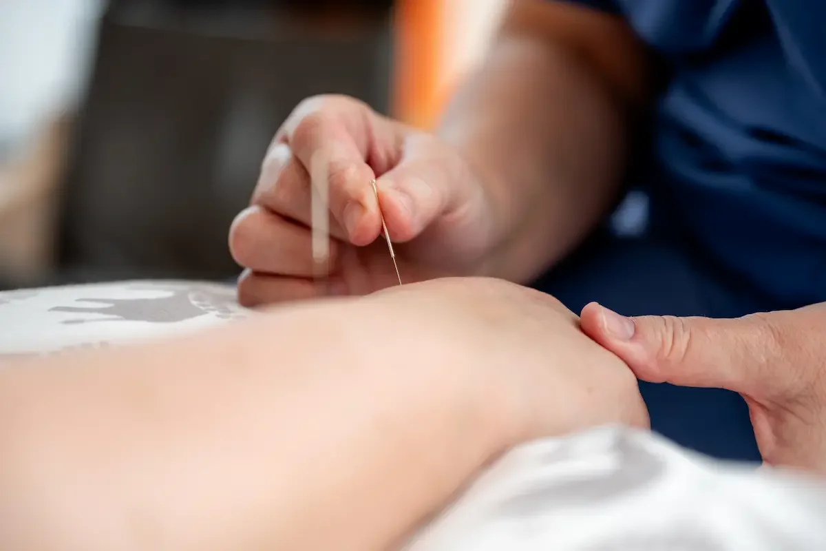 Akupunktur in der Klinik Frauenheilkunde, Geburtshilfe und Senologie | 