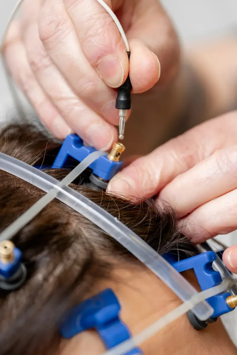 Neurologie | 
